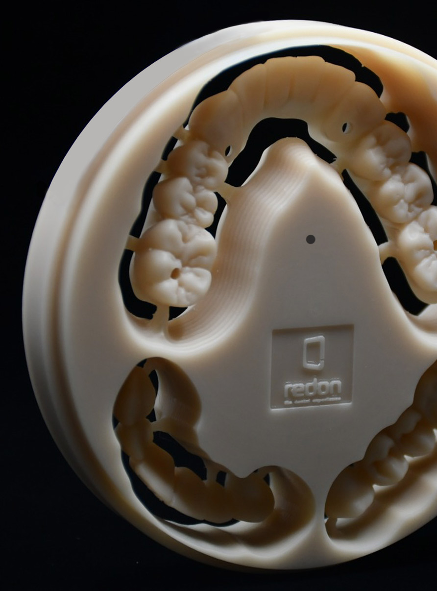 PMMA dental restoration milling